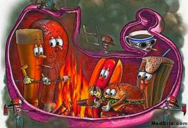 изжога